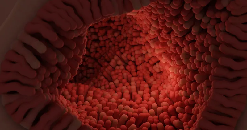 Ulcerative colitis care and treatment